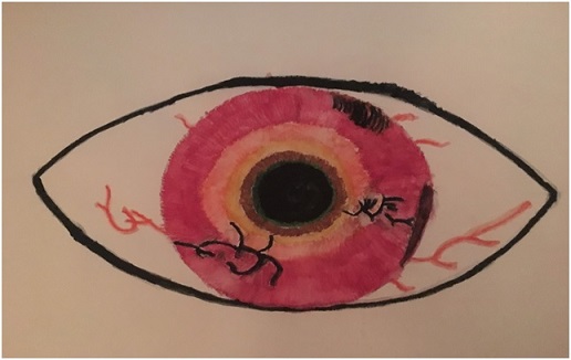 Eye